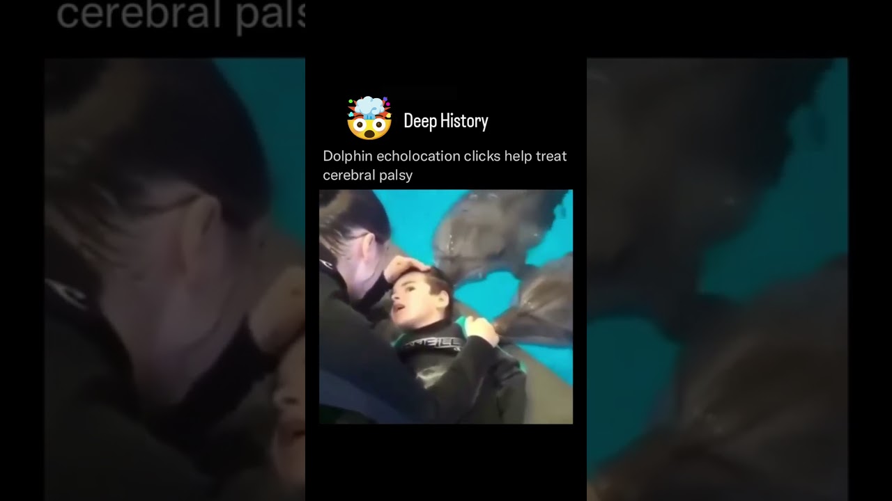 Dolphin echolocation clicks help treat cerebral palsy. 