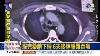 藥丸黏食道 潰瘍穿孔險送命