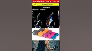 MCQ 14: Board Review Exam- physiology