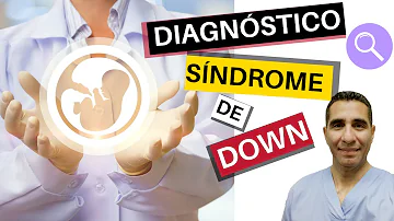 ¿En cuántas semanas se puede detectar el síndrome de Down?