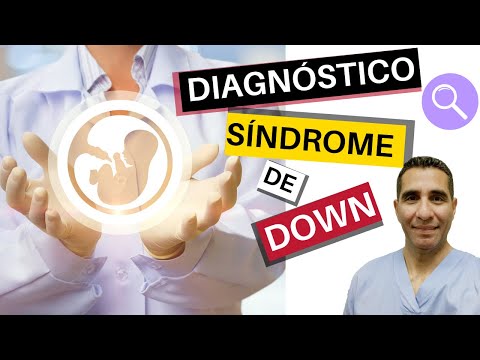 Video: ¿Por qué la PAPP es baja en el síndrome de Down?