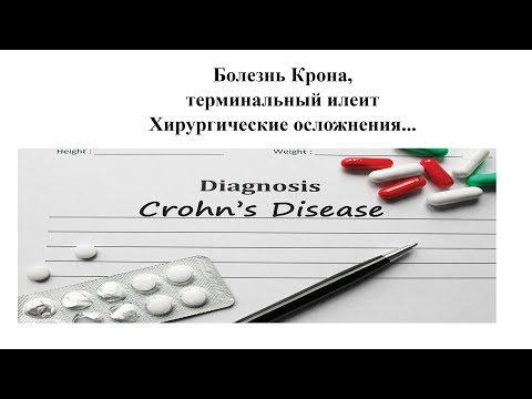 Болезнь Крона. Клиника. Осложнения. Диагностика. Принципы медикаментозного и хирургического лечения.