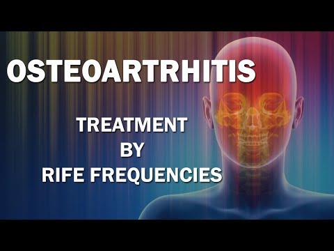 Video: Osteoartritis Hrbtenice: Simptomi, Vzroki In Zdravljenje