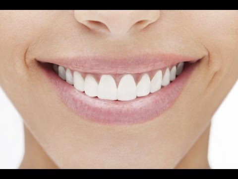 וִידֵאוֹ: האם רופאי שיניים לא יכולים לעשות הלבנת שיניים?