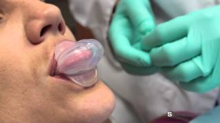 What is a tongue retaining device for sleep apnea? - Dr. Susan M. Welch screenshot 3