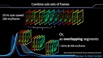 B&H SPCDynamics