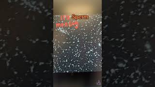 Sperm washing can be helpful during fertility treatment.   #monday #health fertility #ttc #iui