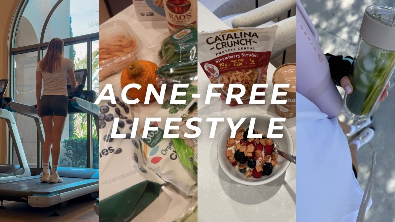 How to stay acne-free (nutrition, groceries, workouts.)