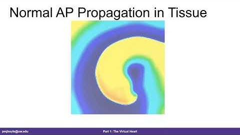 Modeling and Simulation of Cardiac Arrhythmia, February 28, 2020