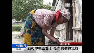 20160421 內戰失去雙手 還能緊握住幸福
