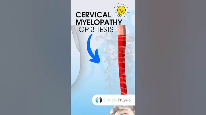Cervical Myelopathy Top 3 Tests #physiotherapy #physicaltherapy #medical