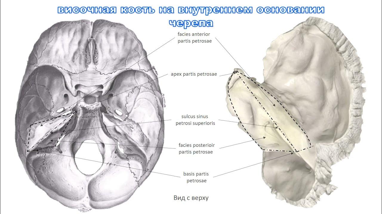 Изменения височной кости. Каналы височной кости анатомия. Височная кость у рептилий. Дисплазия височной кости. Внутренняя ротация височной кости.