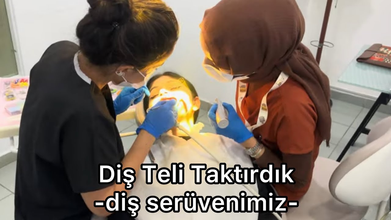 Diş Teli Serüvenimiz