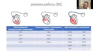 Интерпретация ЭКГ у пациентов со стимуляторами. ЭКГ картина современных алгоритмов кардиостимулятора