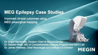 MEG Epilepsy Case Studies explained by Dr. Angel Hernandez, Dr. Saleem Malik, and Dr. James Wheless