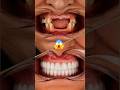 Denture #dentist
