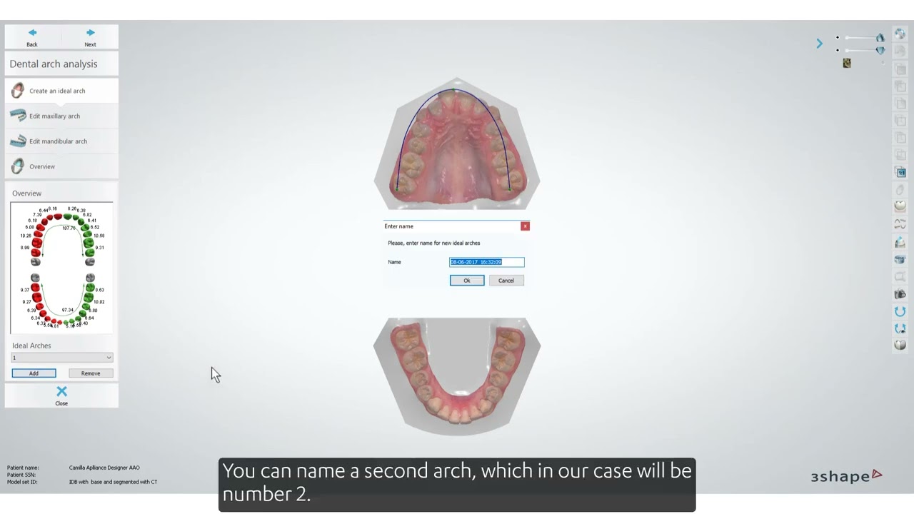 Placing an ideal arch and analysing it in Clear Aligner Studio