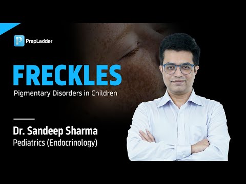 Freckles (Pigmentary Disorders in Children) | Pediatrics Endocrinology