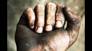 Uncleanness: Understanding Spiritual and Moral Purity ✨🕊️ - Daily Grace Devotional - 1st August 2024