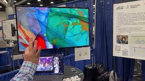 Real-time 3D Hand Gestures for Medical Image Visualization (CVPR 2023 Demo)