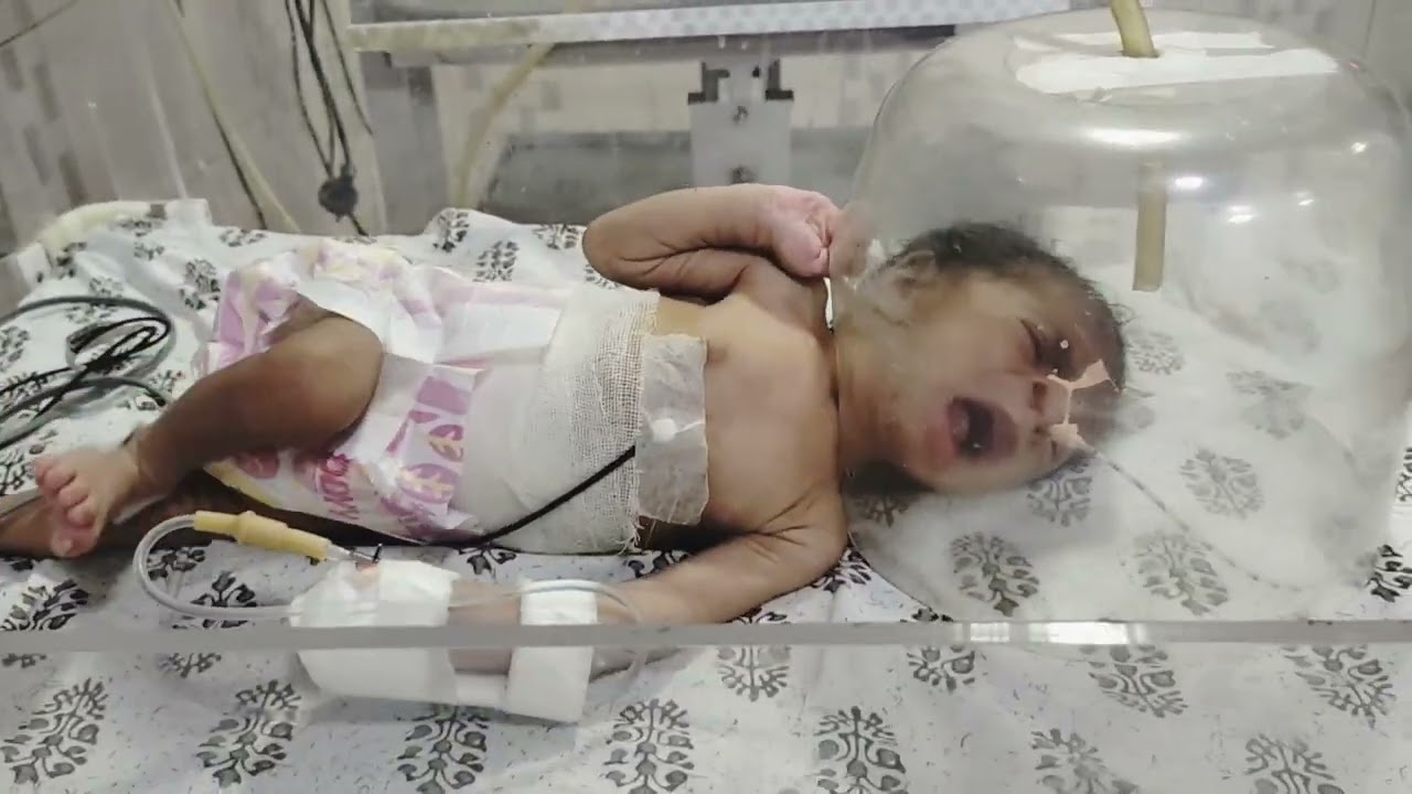 Newborn baby on Oxygen Hood|Oxygen therapy|Surgical Newborn Baby|