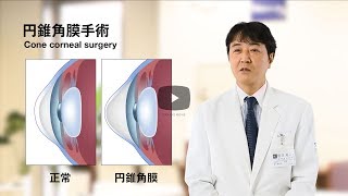 円錐角膜手術｜岡眼科クリニック