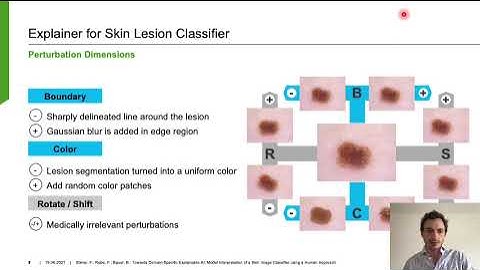 Towards Domain-Specific Explainable AI: Model Interpretation of a Skin Image Classifier (Full)