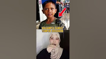 INILAH WAJAH FAREL PRAYOGA SEKARANG #shorts #shortvideo #farelprayoga