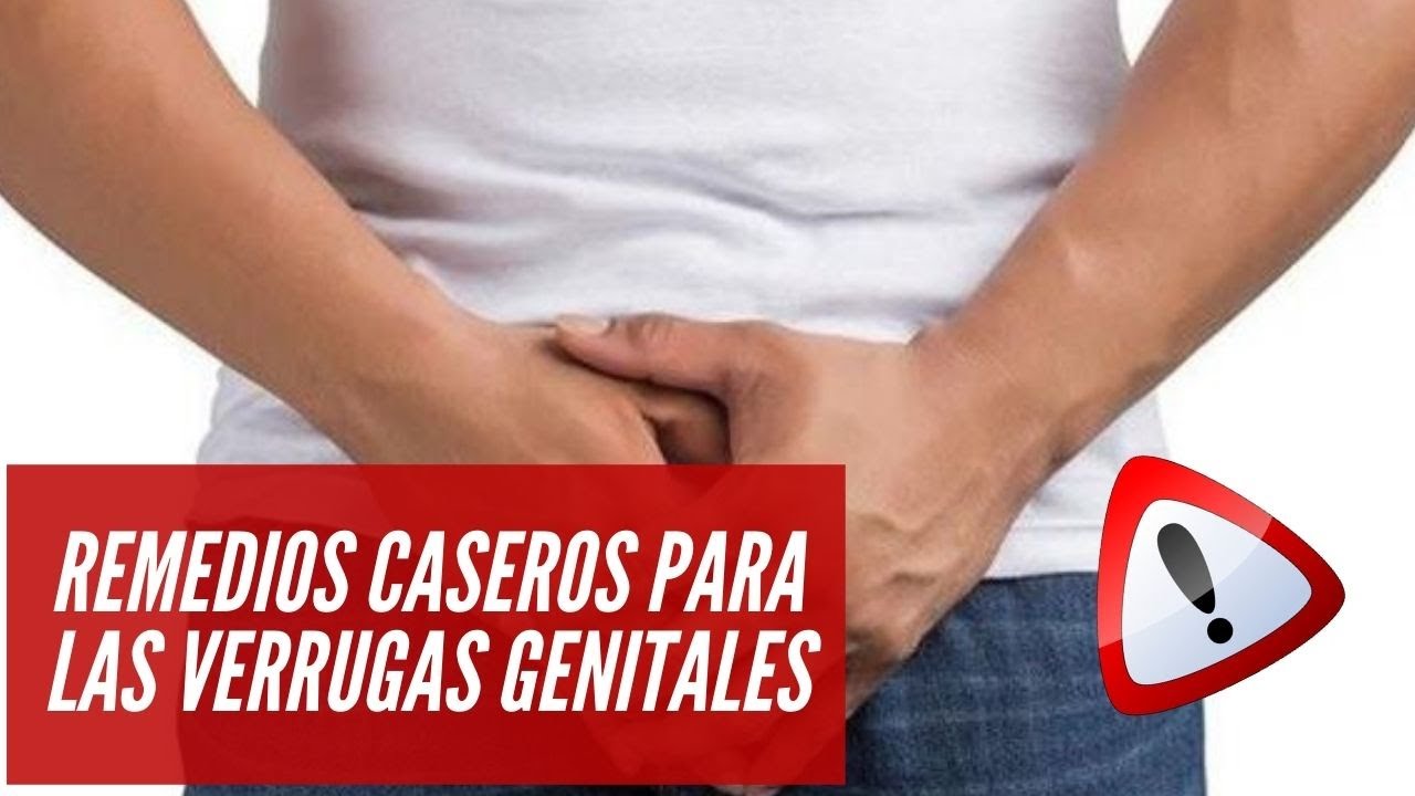 😰 Remedios Caseros Para Las Verrugas En Los Genitales ¿cómo Quitar 