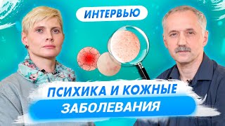 Психологические причины кожных заболеваний. Психонейрофармаколог в гостях у Доктора Виктора