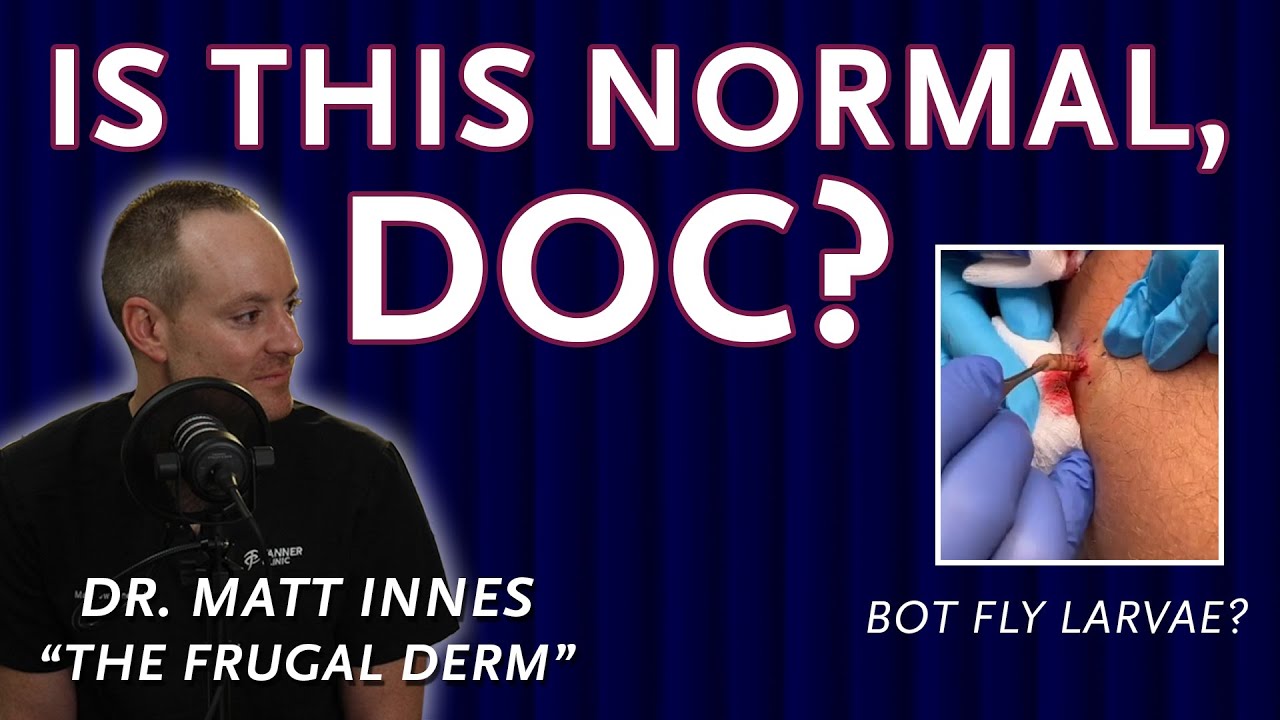 Dermatologist Reveals Skincare Myths & Must-Knows - Is This Normal, Doc?