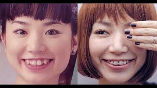 芸能人は歯が命 芸能人の歯並びの矯正before After 全然違う Youtube