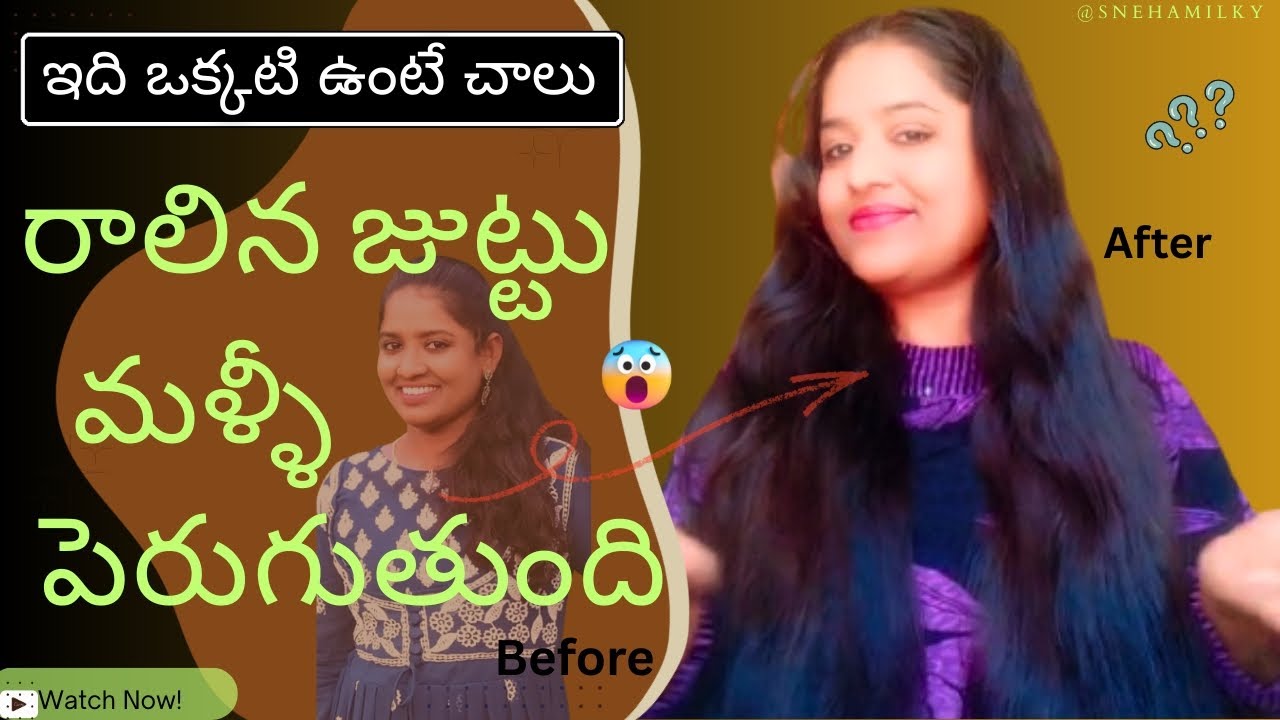 𝗣𝗮𝗿𝘁-𝟮, 𝗕𝗲𝘀𝘁 𝗵𝗮𝗶𝗿 𝗳𝗮𝗹𝗹 𝘀𝗼𝗹𝘂𝘁𝗶𝗼𝗻 𝗮𝘁 𝗵𝗼𝗺𝗲 |ఇది ఒక్కసారి రాసి చుడండి✨Result చూస్తే మీరే shock అవుతారు 