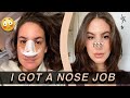 I GOT A NOSE JOB... and documented the entire thing | Jamie Paige