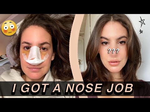 I GOT A NOSE JOB... and documented the entire thing | Jamie Paige