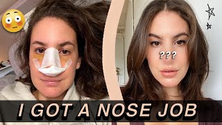 I GOT A NOSE JOB... and documented the entire thing | Jamie Paige