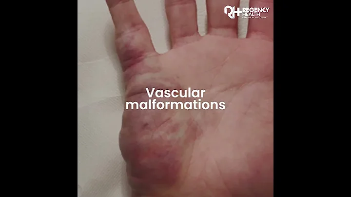 Regency Healthcare | Rare Disease Day