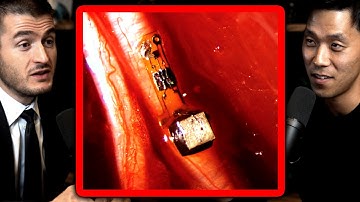 Neural Dust explained | Neuralink - DJ Seo and Lex Fridman