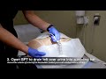 Using a Catheter After Surgery (Foley, intermittent self-catheterization, and suprapubic tube (SPT))