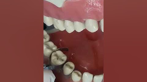 PORTA MATRIZ TOFFLEMIRE Y BANDA MATRIZ.