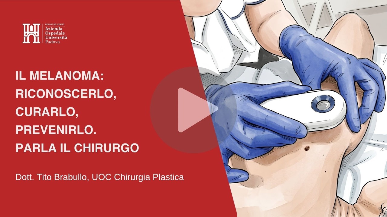 Il melanoma: riconoscerlo, curarlo, prevenirlo. Parla il chirurgo