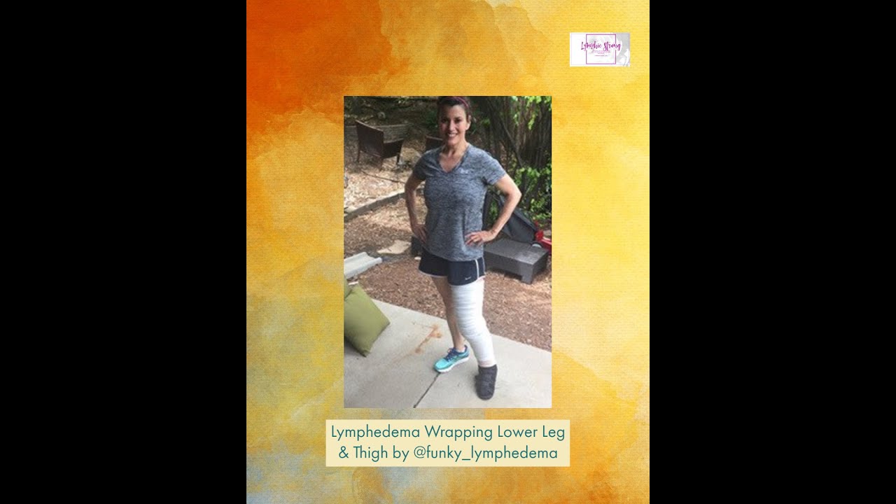 Lymphedema Wrapping Lower Leg & Thigh by @funky_lymphedema
