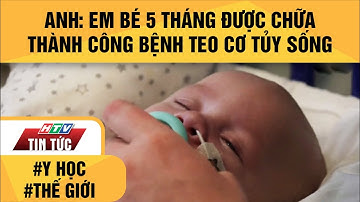 ANH: EM BÉ 5 THÁNG ĐƯỢC CHỮA THÀNH CÔNG BỆNH TEO CƠ TỦY SỐNG | HTV TIN TỨC
