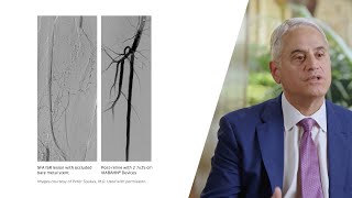 The Conversation On Collaterals In Sfa Isr