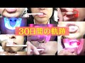 30日間の軌跡～スーパーホワイトLVを使ってみた男性の感想～