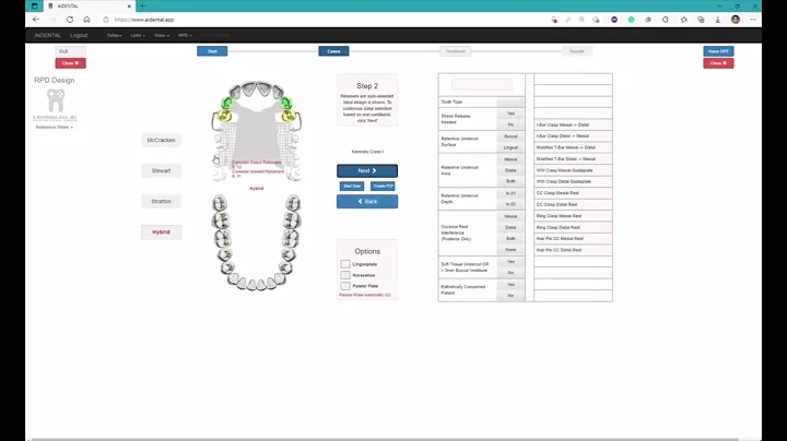 AI Dental RPD Designer: Dein Weg zum perfekten Zahnersatz