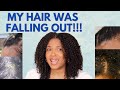 My struggles with DRY/FLAKY SCALP (Seborrheic Dermatitis) and how I addressed it | Exotik_Roots