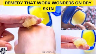 Just 1 Remedy For Wrinkle Free Super Soft Skin | How I Keep My Hand Soft Wrinkle Free Smooth Young screenshot 5