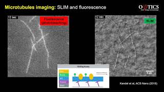 Celebrity SLIM measurement of microtubules Wealth