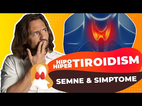 Video: 3 moduri de a identifica semnele de hipertiroidism